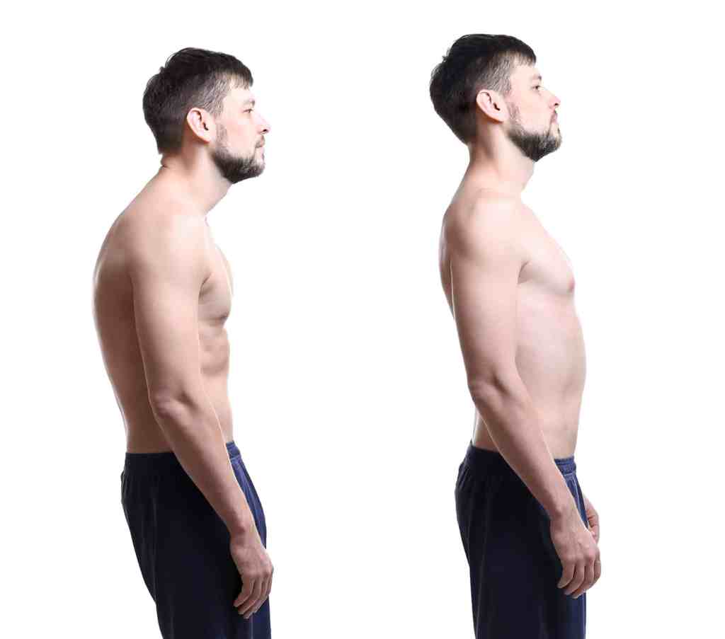 Why Good Posture Is Important for Your Overall&nbsp;Health